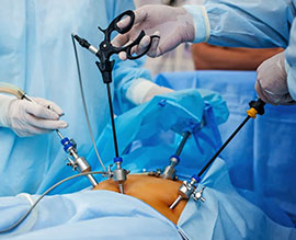 Laproscopy and Endoscopy